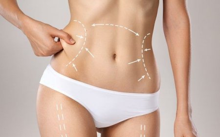 ما الفرق بين شد البطن الكامل والجزئي في الرياض؟