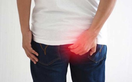 Hemorrhoid Treatment in Riyadh: Understanding Your Options