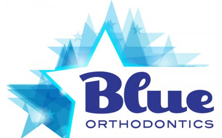 Everything You Need to Know About Invisalign