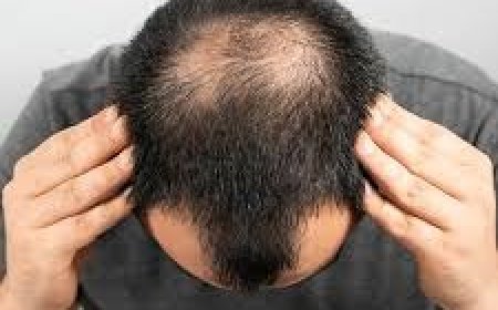 Your Path to Thicker Hair: Hair Transplants in Riyadh