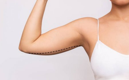 خطوات عملية شد الذراعين في الرياض بالتفصيل