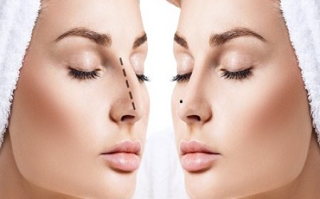 The Role of 3D Imaging in Planning Rhinoplasty