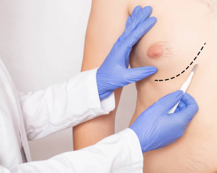 Riyadh’s Secret to a Sculpted Chest: Gynecomastia Surgery
