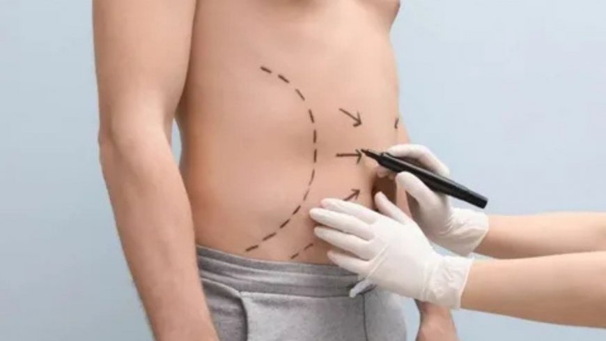 Best Liposuction Surgery in Delhi – Reshape Your Confidence