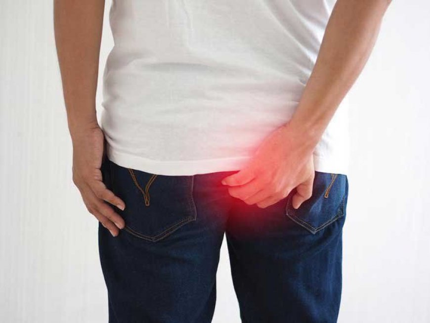 Hemorrhoid Treatment in Riyadh: Understanding Your Options