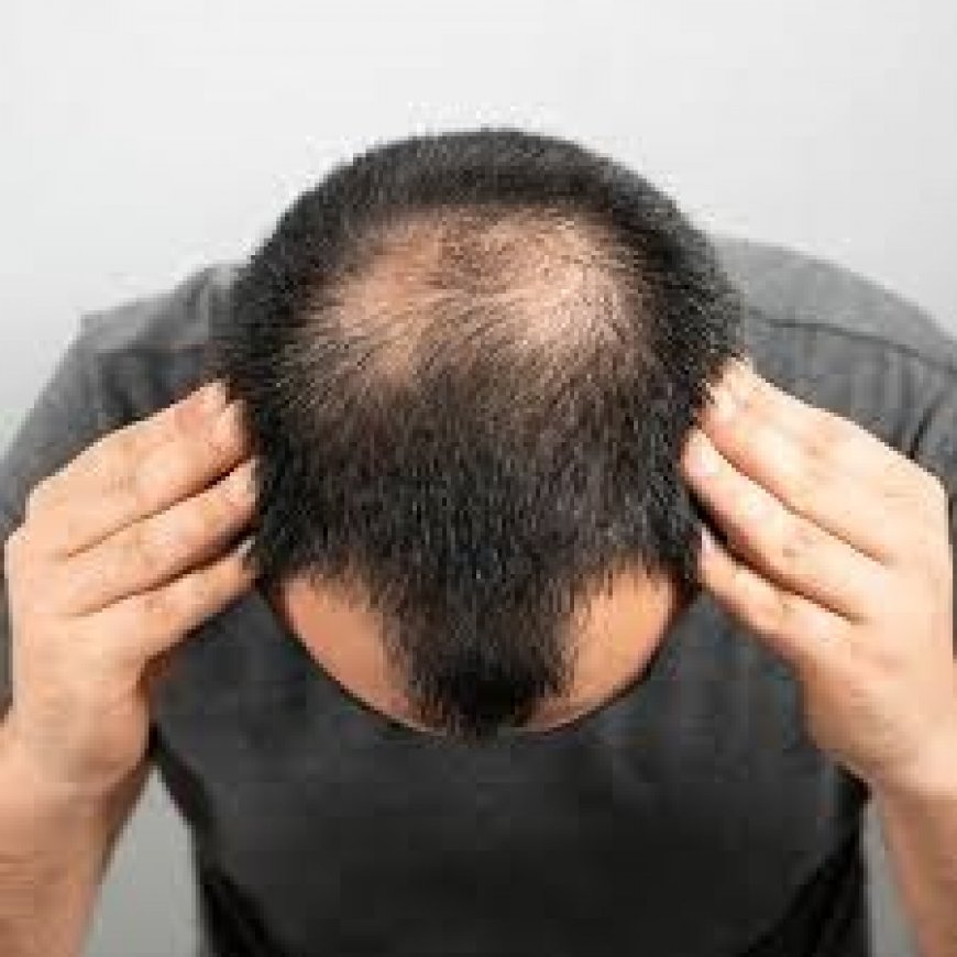 Your Path to Thicker Hair: Hair Transplants in Riyadh