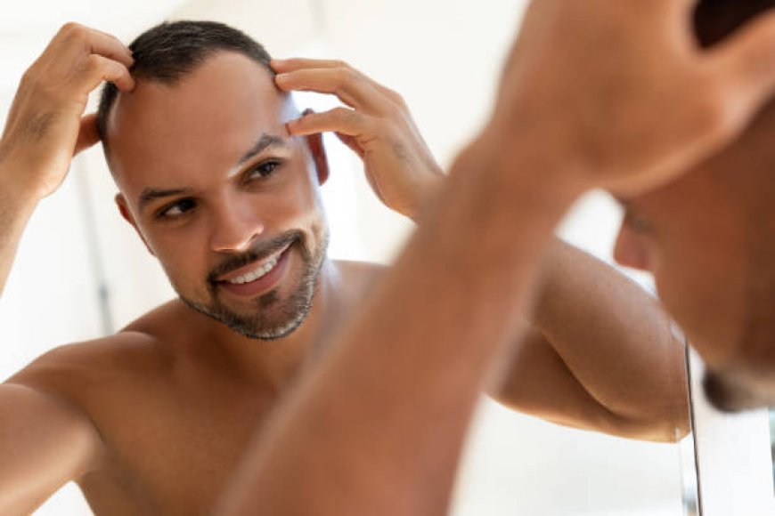 التحضير لزراعة الشعر في الرياض: خطوات أساسية