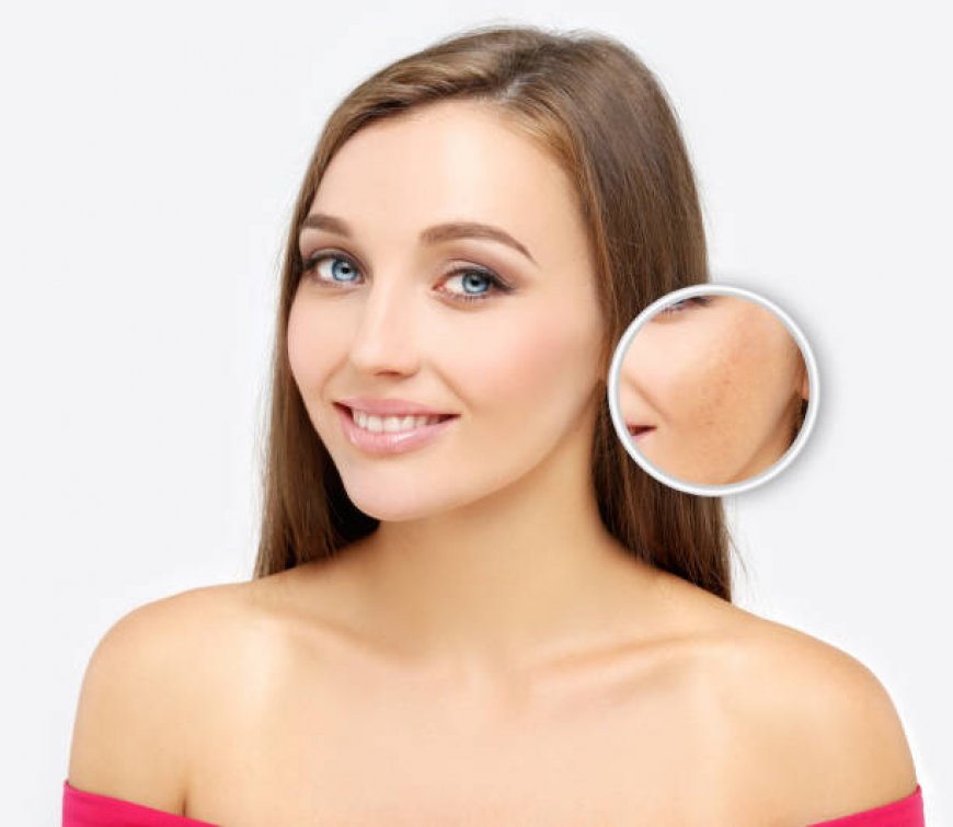 نصائح قبل وبعد التقشير الكيميائي في الرياض