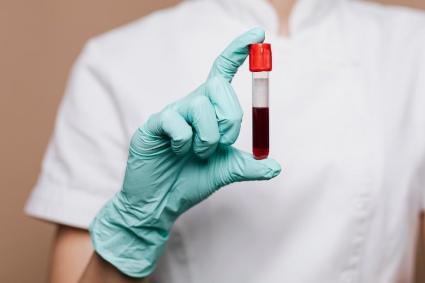 Global Blood Screening Market, Share, Trends, Demand, Growth and Competitive Analysis