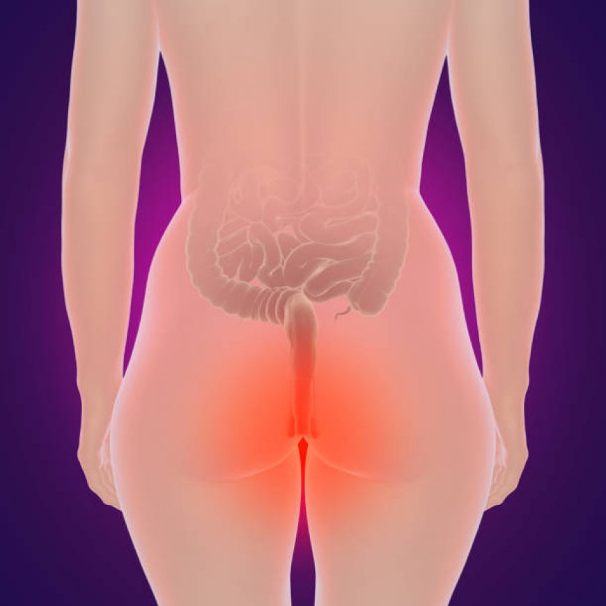 Everything You Should Know About Laser Hemorrhoid Treatment in Riyadh