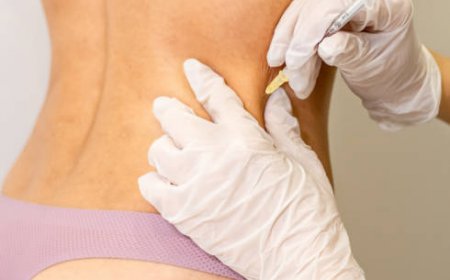 Gynecomastia Surgery in Riyadh: A Path to a New You