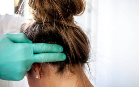 Experience the Benefits of Exosomes Therapy for Hair Loss in Riyadh