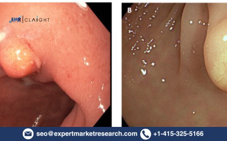Gastric Neuroendocrine Tumor Market – Global Industry Size, Trends & Forecast to 2034