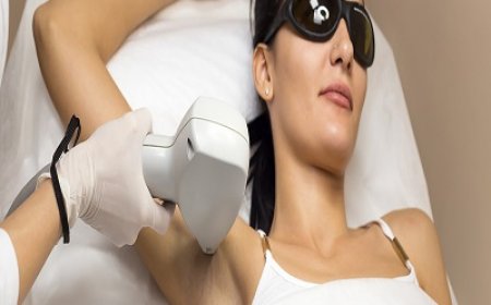 Best Time of Year to Start Laser Hair Removal