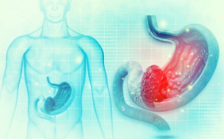 Gastric Balloon in Riyadh: A Comprehensive Guide