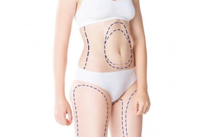 How Thigh Lift Surgery in Riyadh Enhances Body Contour