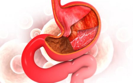 Gastric Balloon in Riyadh for Non-Surgical Weight Loss