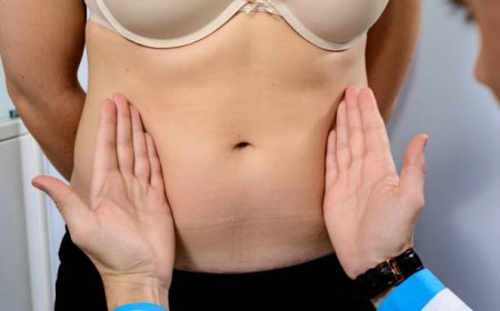 Expert Insights on Tummy Tuck in Riyadh