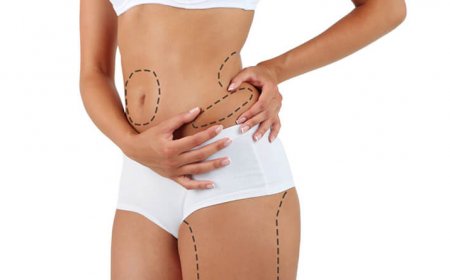 Thigh Liposuction in Islamabad: Benefits and Cost