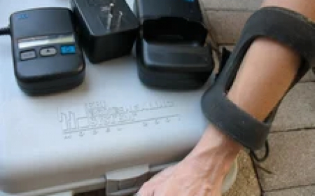 Why You Should See a Bone Growth Stimulator Specialist for Faster Healing