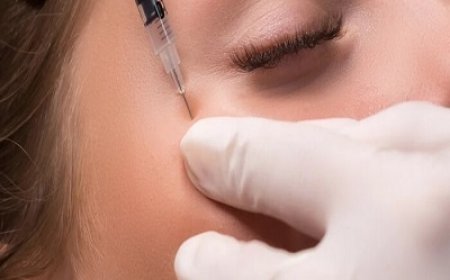 Smile Line (Nasolabial Fold) Fillers: Are They Worth It?