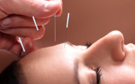 Beauty Benefits of Cosmetic Acupuncture: A Natural Alternative to Botox