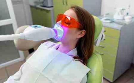 Whitening Without the Pitfalls: Avoid Common Smile Errors