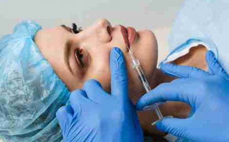 Achieve Beautiful, Fuller Lips with Expert Filler Techniques