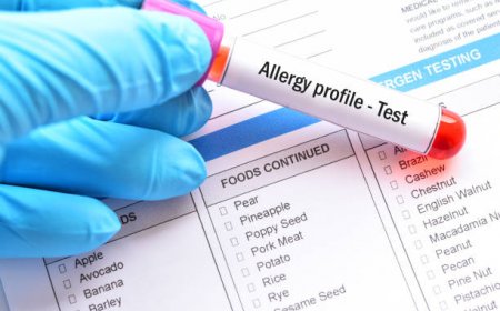 Understanding Food Allergy Testing and Its Benefits