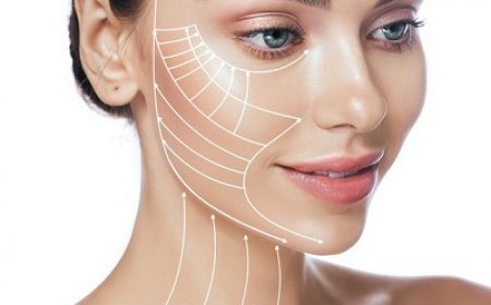 What to Expect During Facelift Recovery