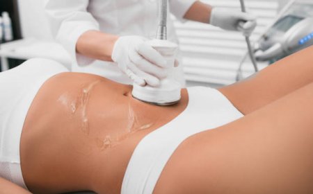 Liposuction in Riyadh: Before and After Tips
