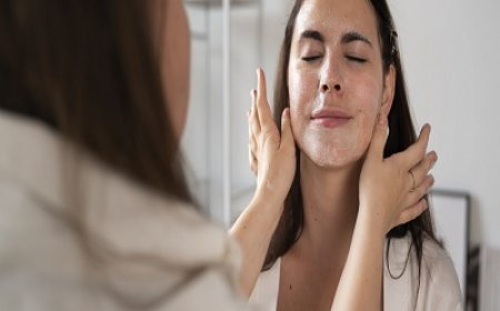 Why Melasma Keeps Coming Back and How to Prevent It in Islamabad