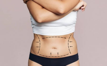 How Thigh Lift Surgery in Riyadh Improves Shape