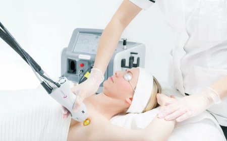 Laser Mole Removal: Quick & Painless