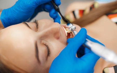 Teeth Cleaning in Riyadh: Quick & Effective