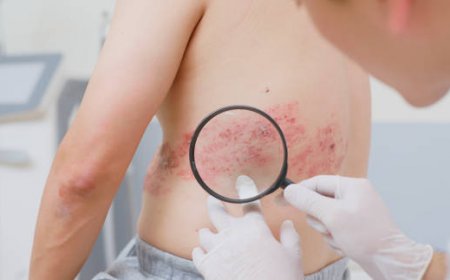 صور توضح تطور الحزام الناري وأهم النصائح