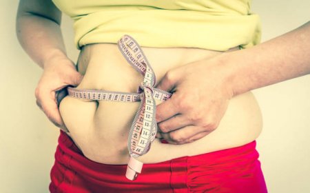 Expert Advice on Obesity Surgery in Riyadh