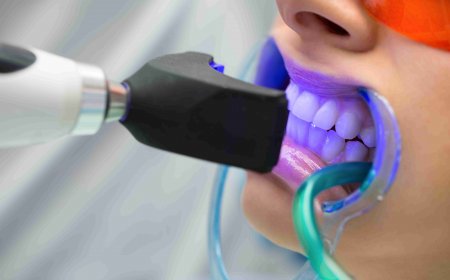 Teeth Whitening Lifespan: What Affects It & How to Extend