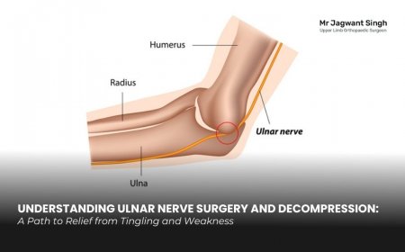 Ulnar Decompression Surgery & Ulnar Nerve Surgery – Understanding Treatment, Recovery and Benefits