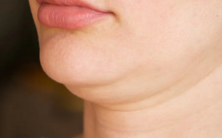 How to Get Rid of a Double Chin Without Surgery