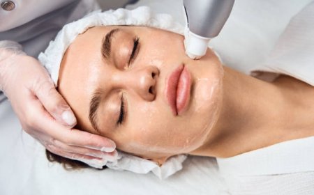 Chemical Peels Riyadh: Clear Skin Starts Here