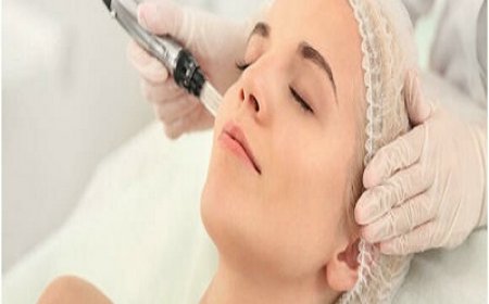 What Is Derma Roller Treatment and How Does It Work?