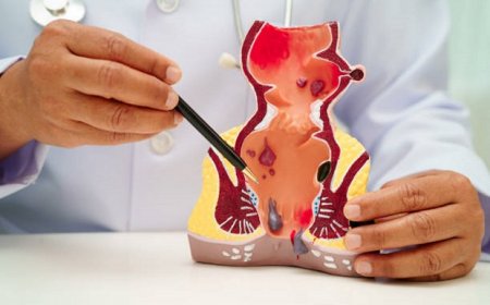 علاج البواسير بالليزر في الرياض.. تقنية متطورة ونتائج مضمونة