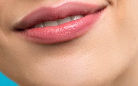 Lip Fillers vs. Lip Implants: Which One is Right for You?