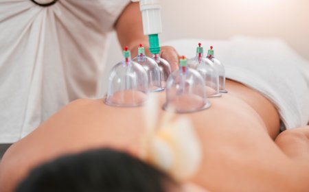 Can Hijama Aid in Weight Loss? Here’s What You Should Know
