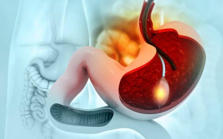 نتائج مبهرة من عملية بالون المعدة بالرياض