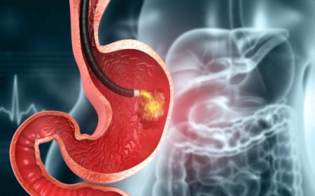 Best Places for Gastric Balloon in Riyadh in 2025