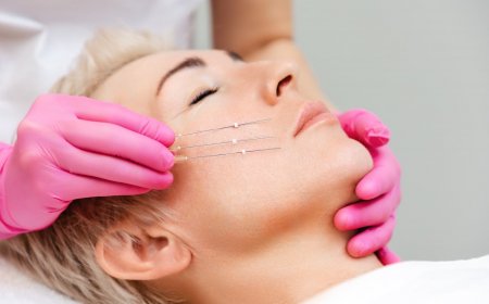 Thread Lift vs. Fillers: Pros and Cons