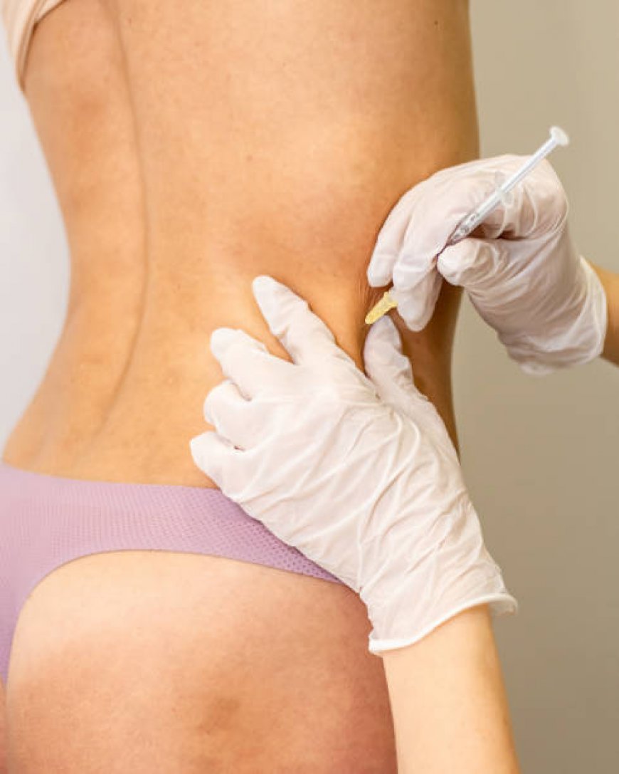 Gynecomastia Surgery in Riyadh: A Path to a New You