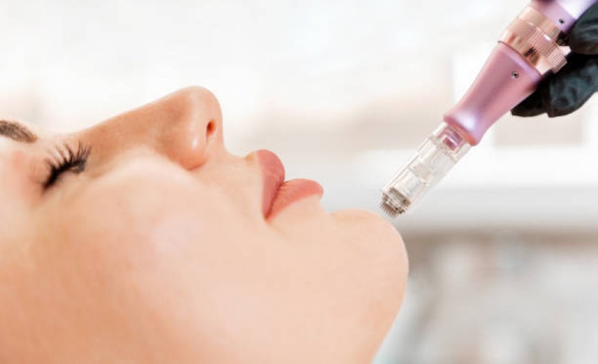 Derma Pen Cost, Results, and Safety Tips